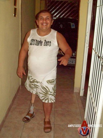 amputado_rodolfo.jpg