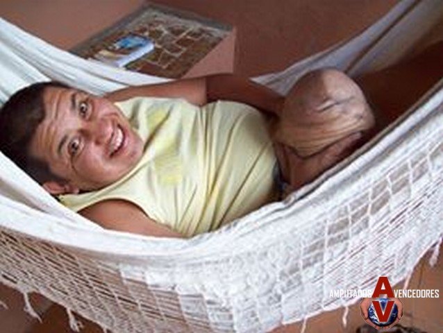 rodofo teixeira amputado