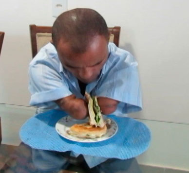 comer-sozinho-amputacao