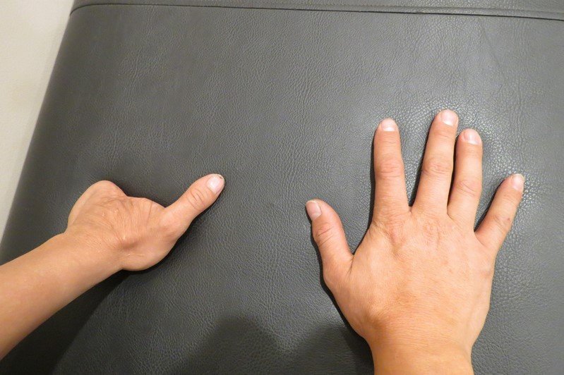 acidente domestico amputacao maos