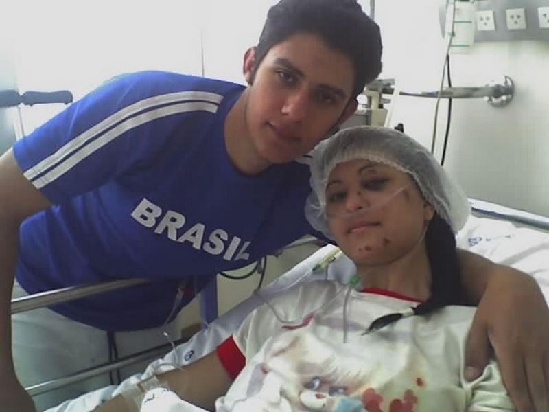 acidente de moto amputacao