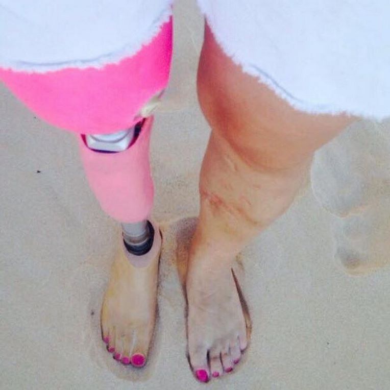 acidente de moto joelho