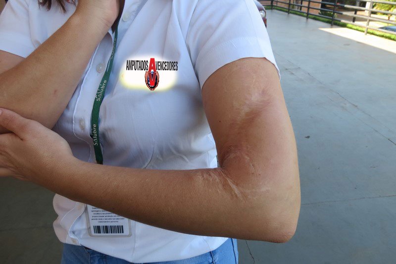 trabalho infantil acidente segurança