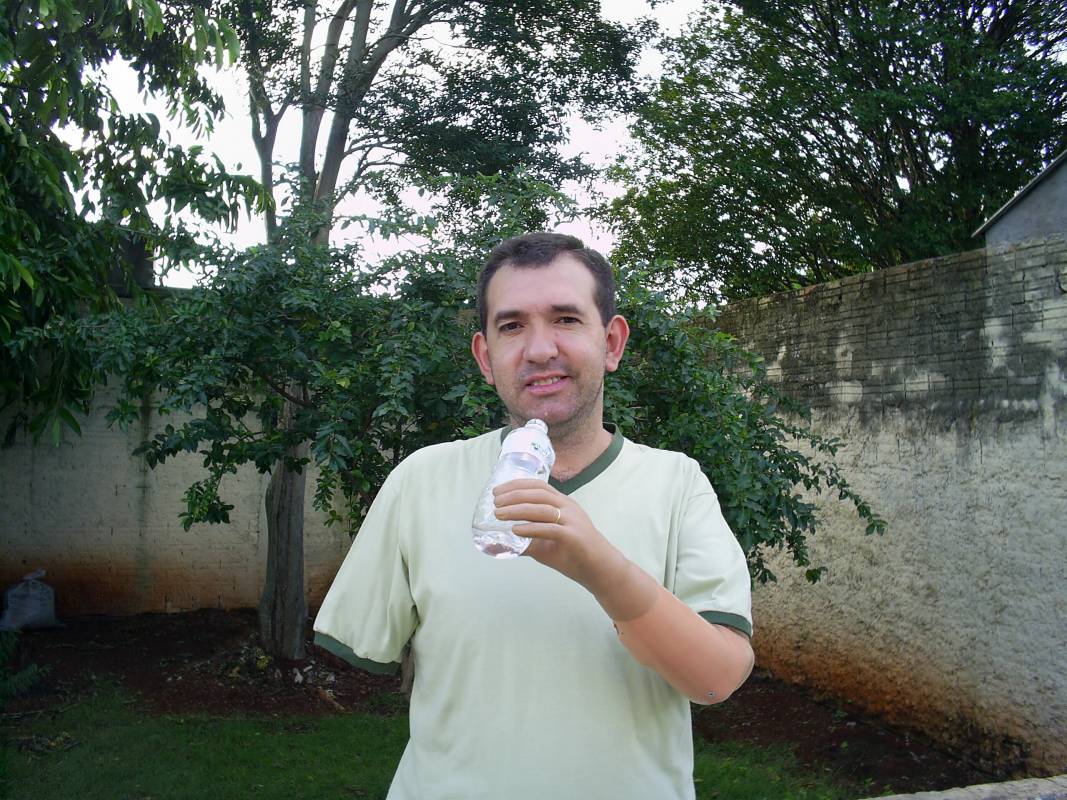 protese-braço-flavio-peralta