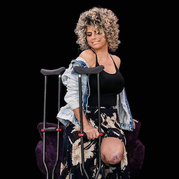 eu-perdi-a-perna-amputacao