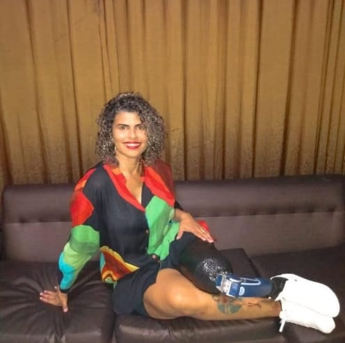 eu-perdi-a-perna-protese