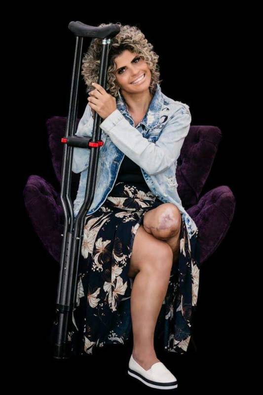 eu-perdi-a-perna-fabiola